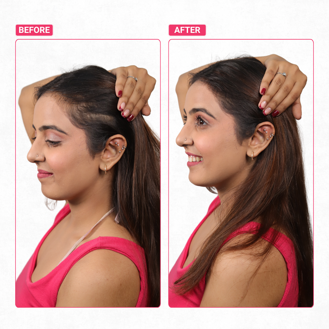 Invisible Wide Patch | 100% Real Human Hair