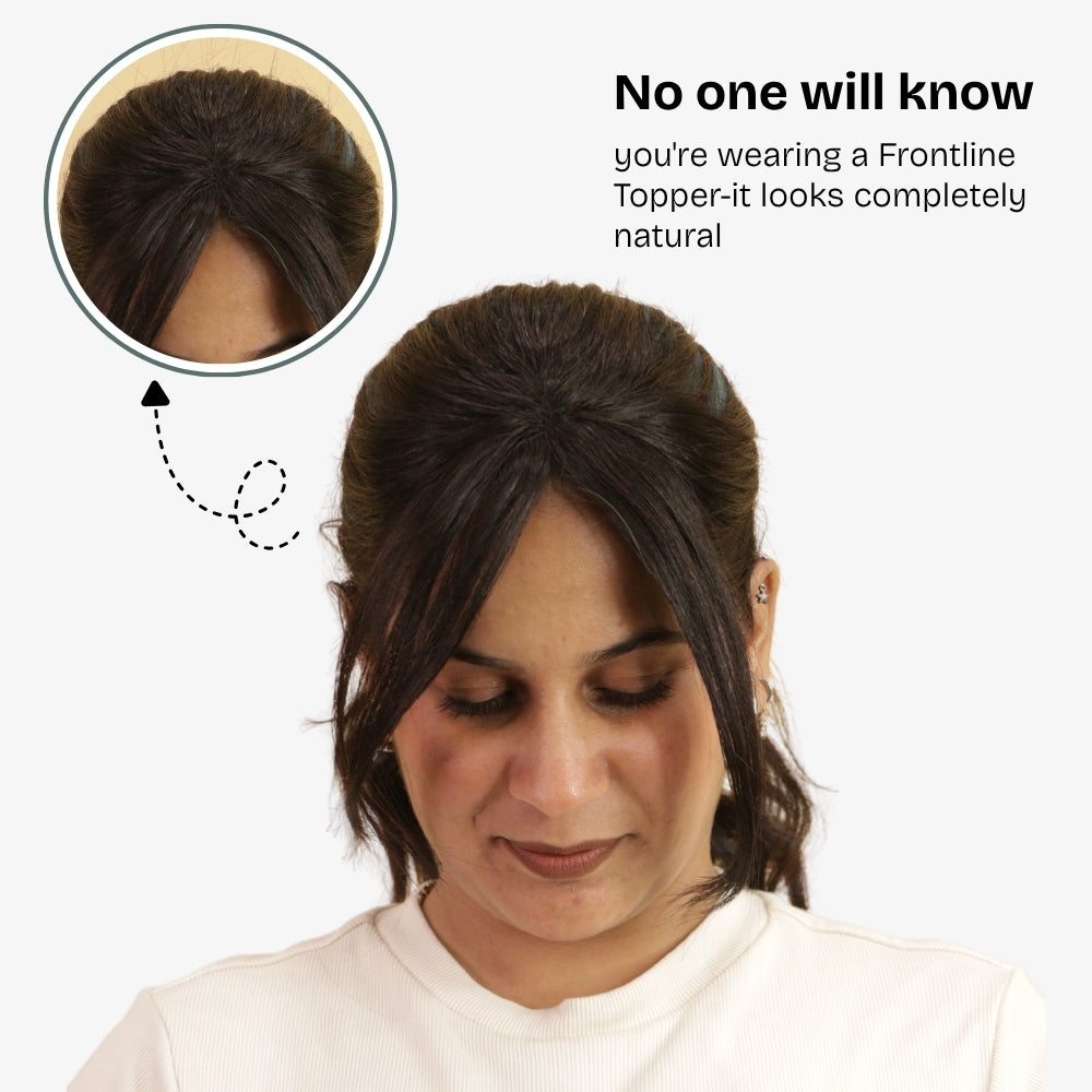 Front Hairline Topper for Women | 100% Human Hair