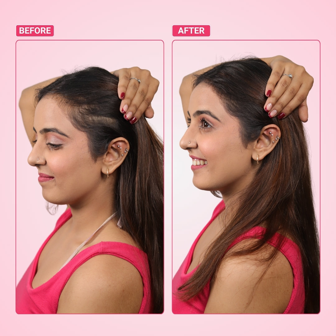 Invisible Wide Patch Hair Extension for Volume and Coverage