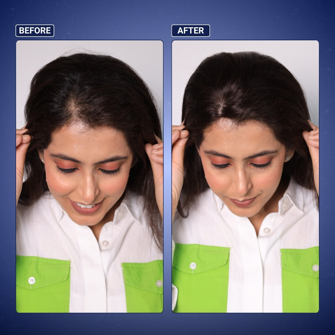 2x3 Silk Base Hair Extension Topper | Real Human Hair Patch