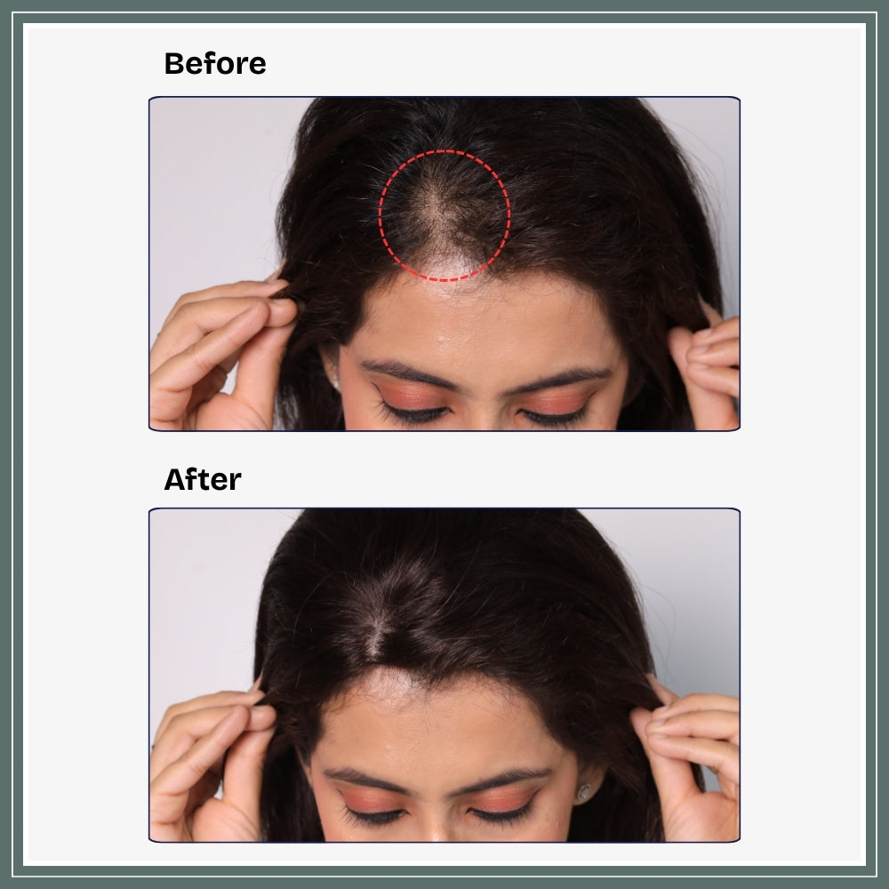 2x3 Silk Base Topper | 100% Real Human Hair