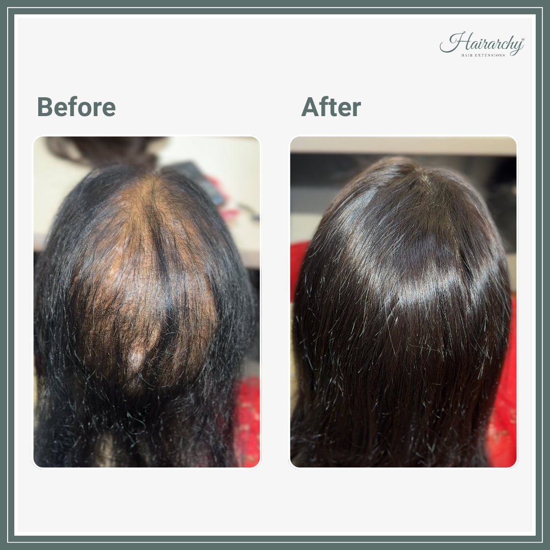 9×6 Lace Base Hair Topper for Women – Natural Scalp Look | Hairarchy Hair