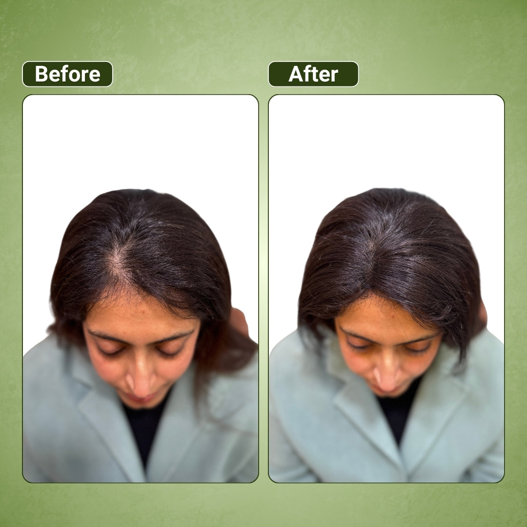 1x2 Lace Base Topper for Women | Natural scalp Finish | Hairarchy Hair