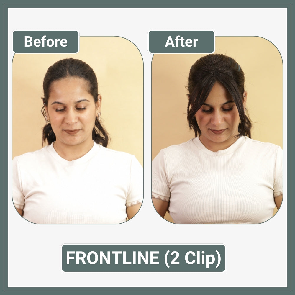 Front Hairline Topper for Women | 100% Human Hair